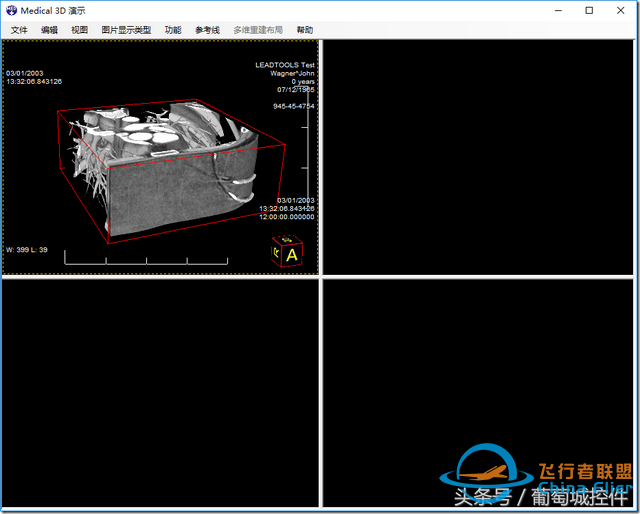 LEADTOOLS医学三维影像演示使用入门-1148