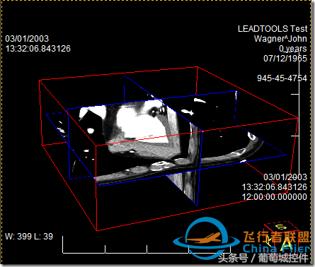 LEADTOOLS医学三维影像演示使用入门-9319