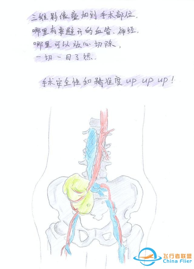 医学领域的“AR 3D”技术究竟有多炫？10幅手绘漫画给你讲透-2560